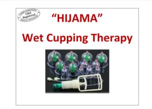 hijama book by hijama nation