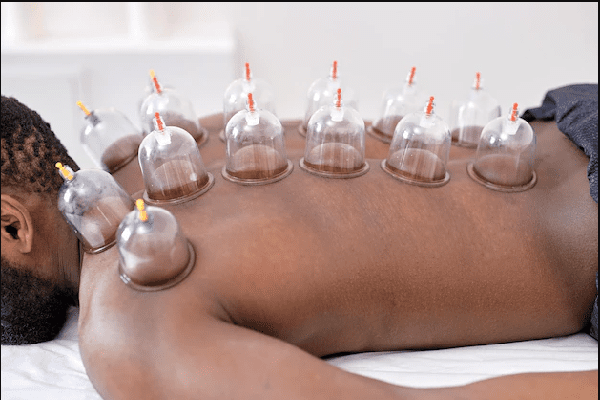 Hijama FAQ s