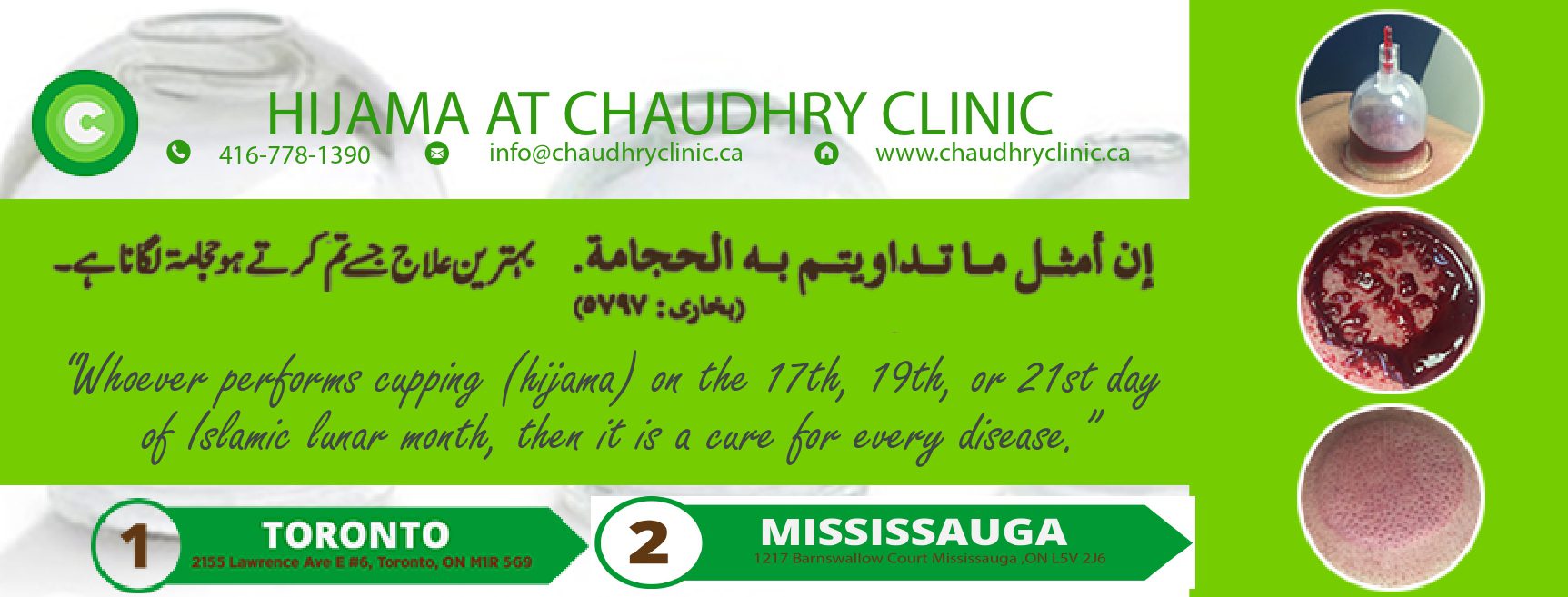 hijama banner