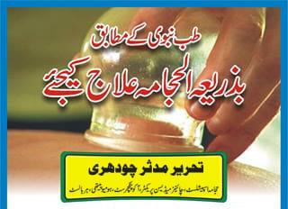 Hijama History